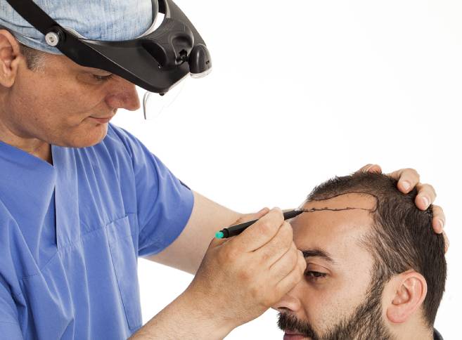 top hair transplant clinic near me